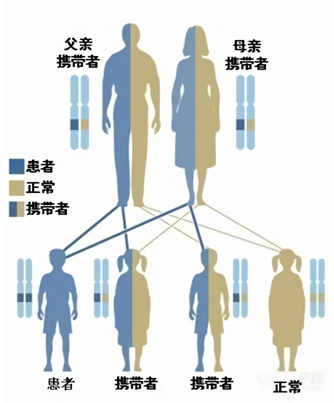 29岁苯丙酮尿症患者图片