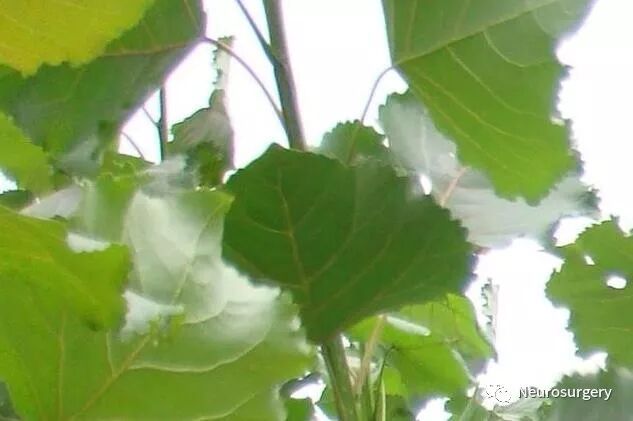 怎么区分显微剪刀医学科普：显微外科技术_https://www.jmylbn.com_新闻资讯_第16张