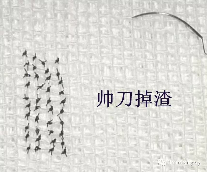 怎么区分显微剪刀医学科普：显微外科技术_https://www.jmylbn.com_新闻资讯_第11张