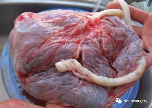 怎么区分显微剪刀医学科普：显微外科技术_https://www.jmylbn.com_新闻资讯_第20张