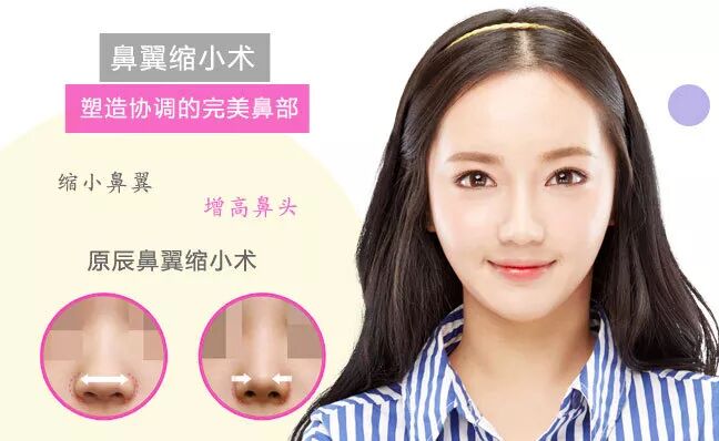 日本整形鼻翼缩小术 变成精致的鼻子俏挺灵动气质提升 日本整形美容资讯 微信公众号文章阅读 Wemp