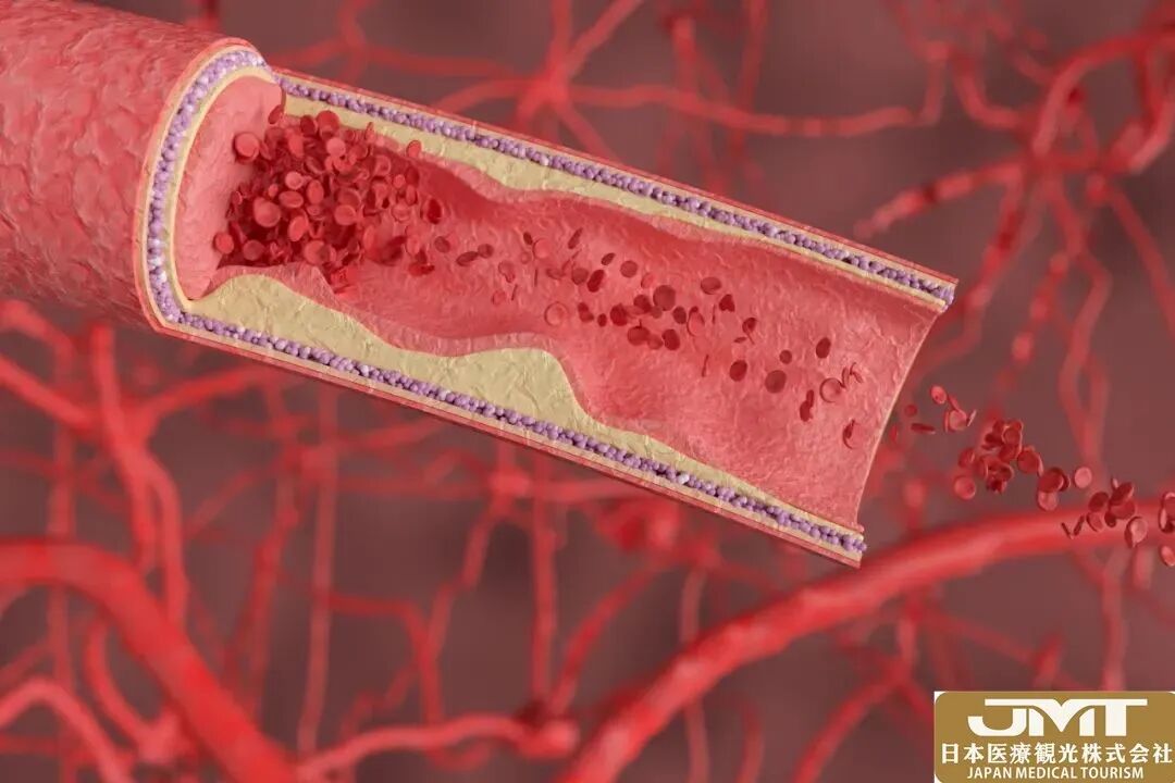 血压什么动物长颈鹿是地球上高血压最严重的动物？原因竟在长长的脖子_https://www.jmylbn.com_新闻资讯_第3张