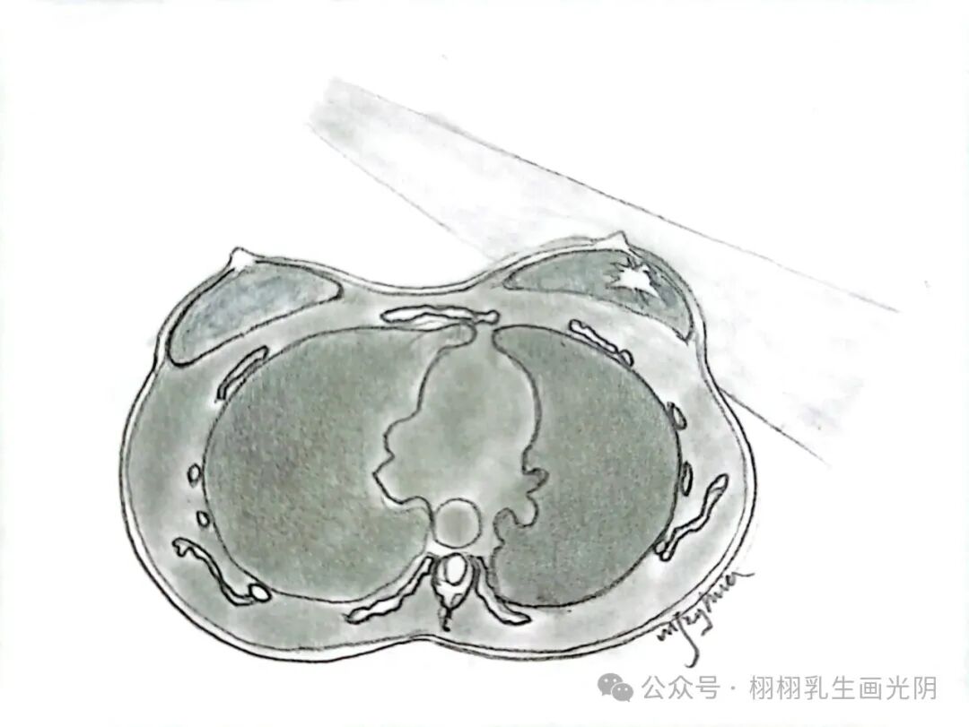 乳腺触诊成像怎么看乳腺检查全攻略：全方位守护乳腺健康_https://www.jmylbn.com_新闻资讯_第1张