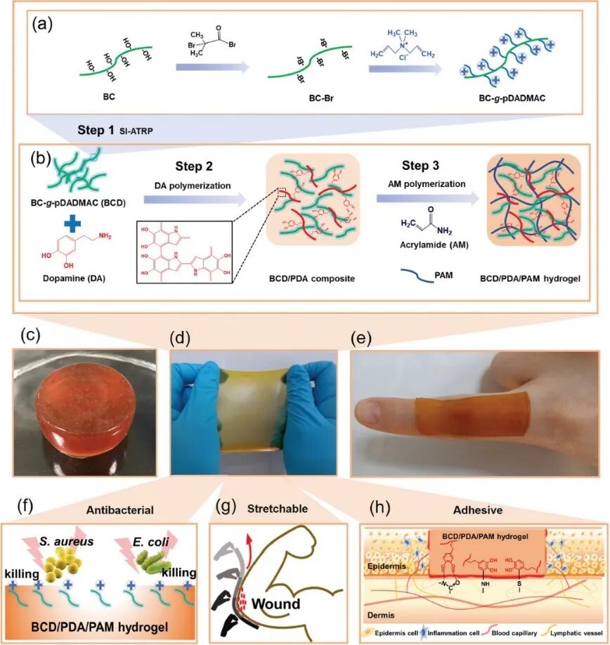 水凝胶伤口敷料怎么用让细菌无处遁形，让伤口安全愈合，一文带你看抗菌水凝胶敷料的设计策略_https://www.jmylbn.com_新闻资讯_第2张