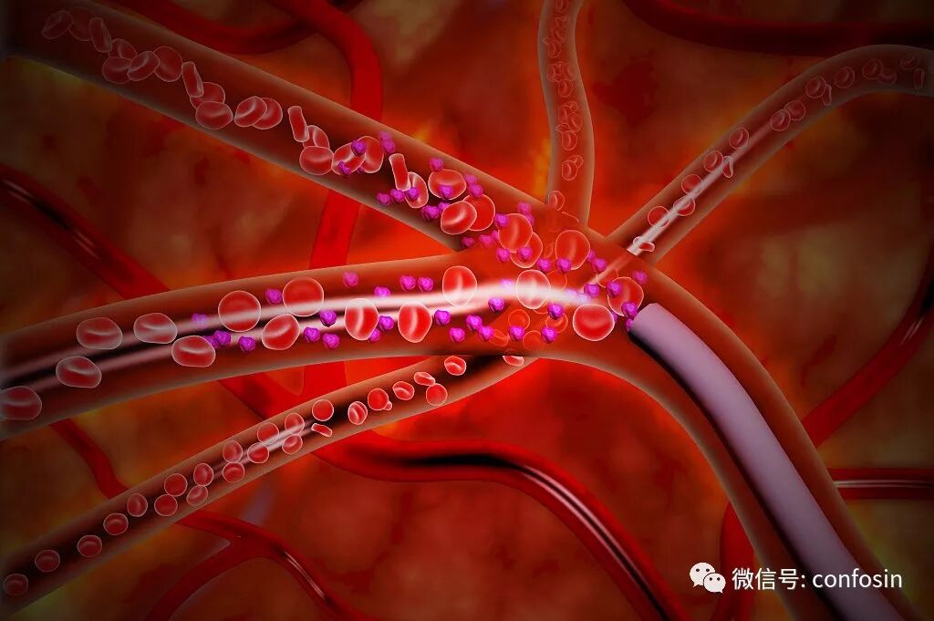 晨起先喝水还是先刷牙？医生给出明确答案