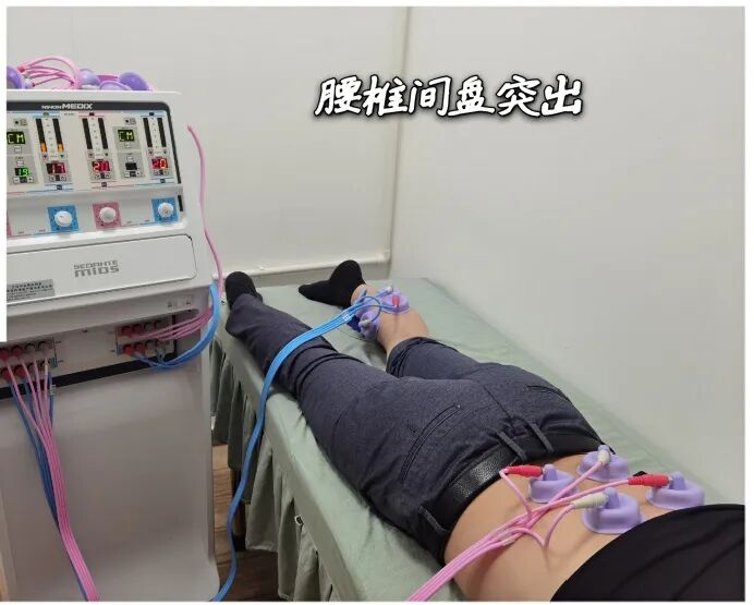 干扰治疗仪怎么使用【康复学术】颈肩腰腿痛治疗神器——干扰电治疗仪_https://www.jmylbn.com_新闻资讯_第20张