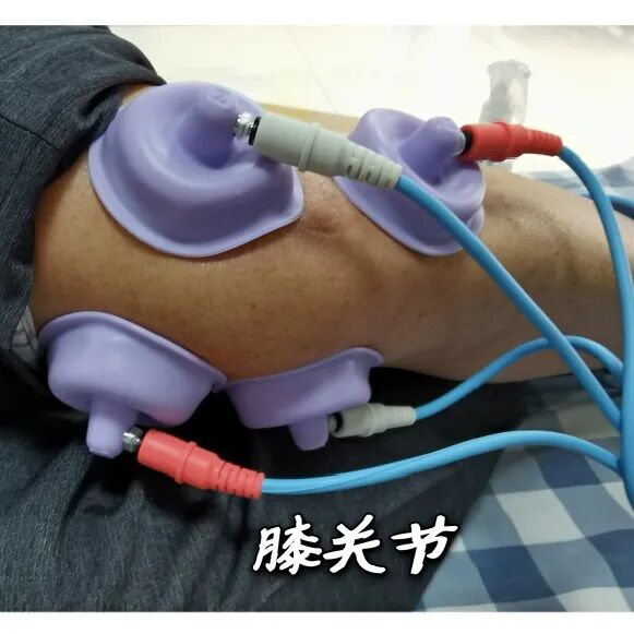 干扰治疗仪怎么使用【康复学术】颈肩腰腿痛治疗神器——干扰电治疗仪_https://www.jmylbn.com_新闻资讯_第26张