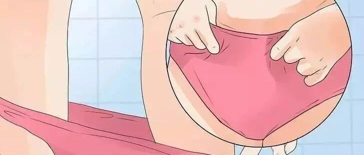 白带多、有异味，内裤上老是湿一块怎么回事？