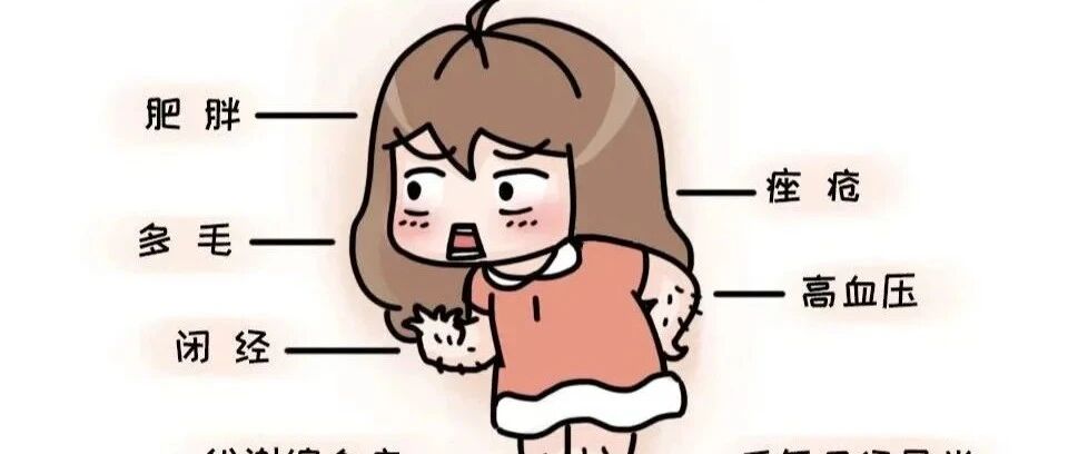 月经紊乱、长痘、肥胖？当心多囊卵巢综合征！