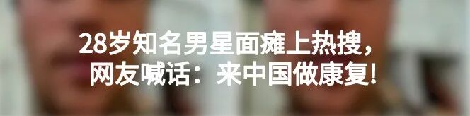 为什么会有单关节器械膝关节功能评估方法：单腿跳跃测试_https://www.jmylbn.com_新闻资讯_第11张