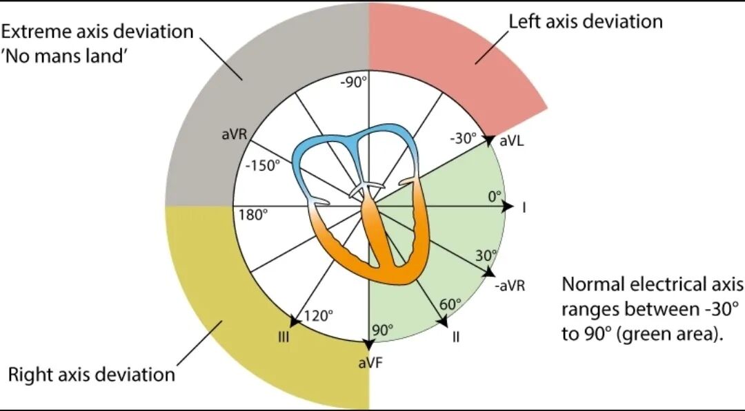 日本心电图怎么用日本研究-心电图电轴左偏的患者不良事件风险增加_https://www.jmylbn.com_新闻资讯_第4张