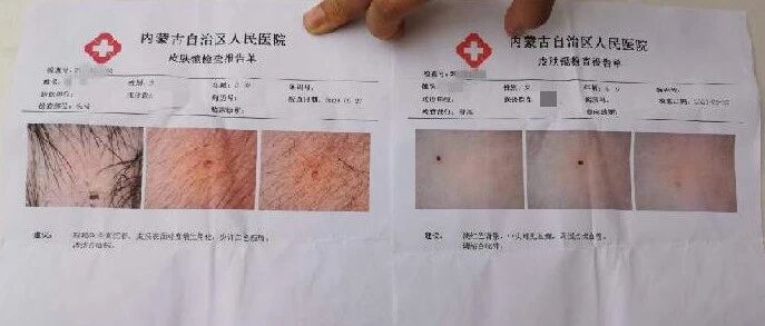 幼儿园有“容嬷嬷”？