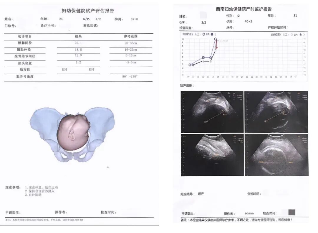 产程三维导航是什么【必看】准妈妈看过来！什么是“三维导航仪”？_https://www.jmylbn.com_新闻资讯_第21张