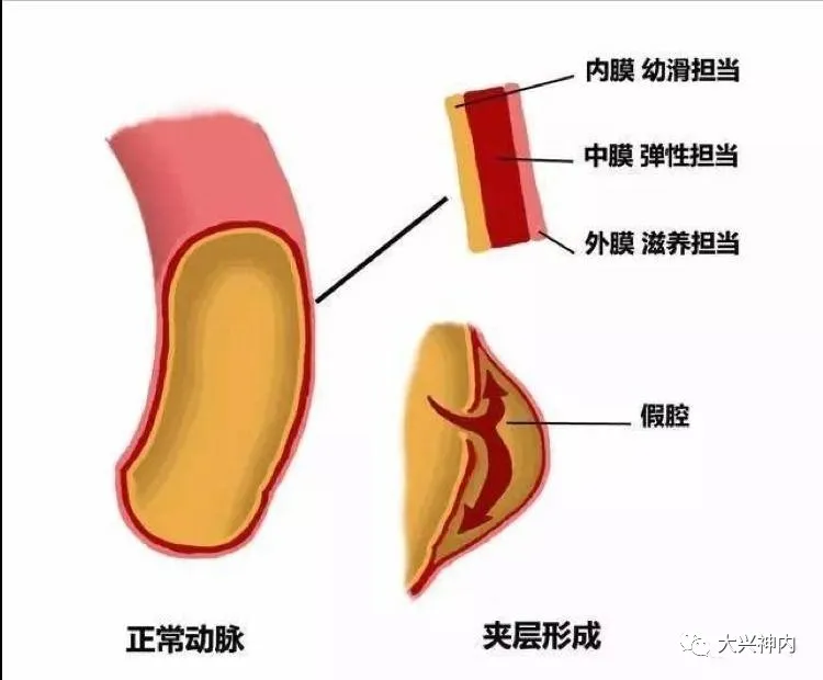 科学网 警惕 颈部按摩不当 可诱发脑梗 苗建亭的博文