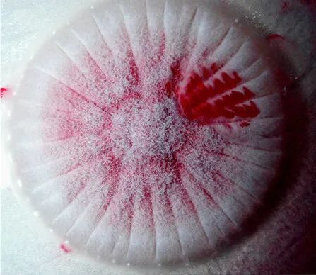 长按二维码关注我们,来留言吧日历娘今日头像红曲霉科 (面包上的)红色