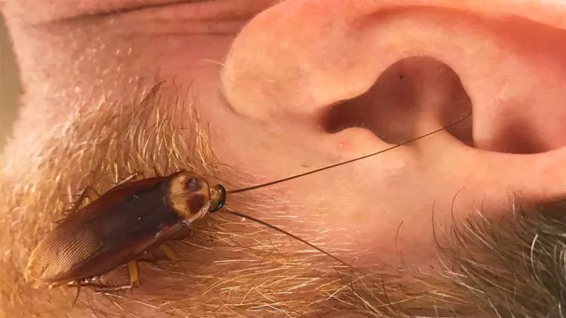 蟑螂进耳朵图片