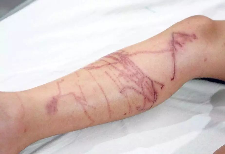 如果在土澳玩生存游戏你能活到第几关