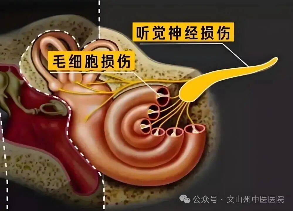 中西医结合疗法，突破突发性耳聋护理难题荣获省级奖项，彰显中西医结合护理创新实力(图2)