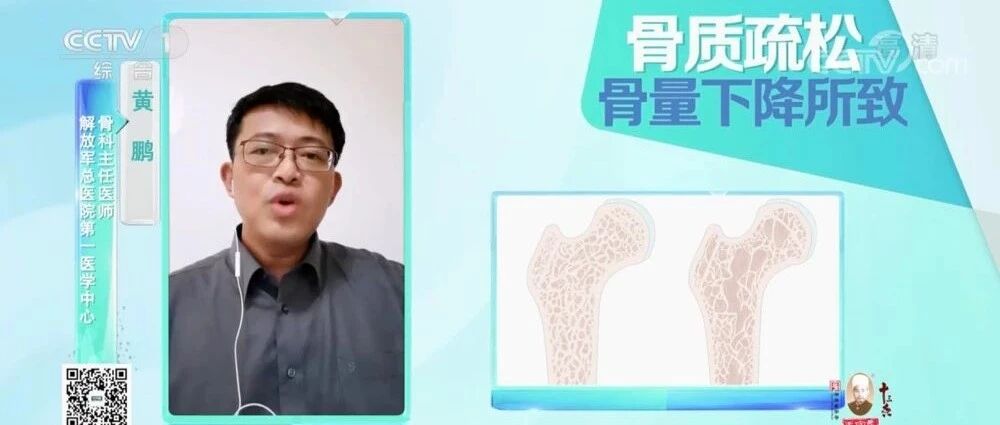四大因素可能导致年轻人骨头变“糠” 骨质疏松不是老年人“专利”！