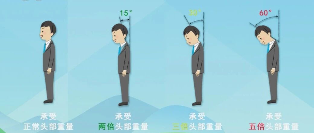 警惕！这些不良生活习惯正在伤害您的颈椎