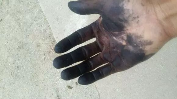 染发剂搞到自己的手上,周一去上班被同事看到了说:"你呀,周日去挖煤了