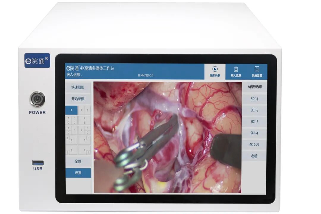 吻合器怎么用的超适用范围使用吻合器 隐蔽风险知多少_https://www.jmylbn.com_新闻资讯_第2张