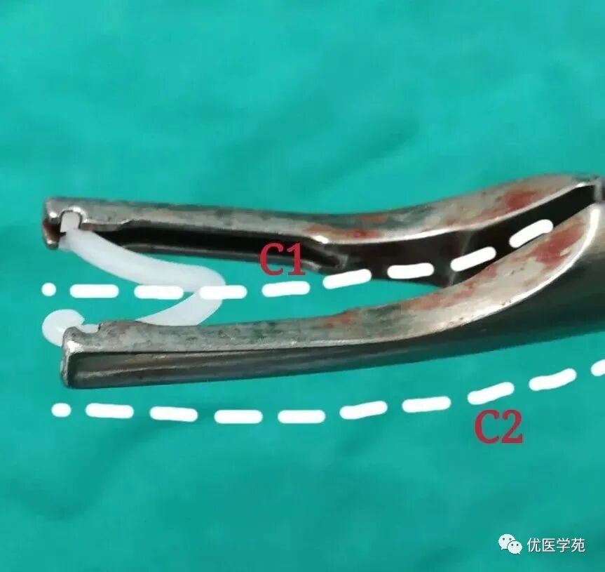为什么手术会用到结扎夹手术兵器谱篇——止血夹之Hemolok夹，您用对了吗_https://www.jmylbn.com_新闻资讯_第7张