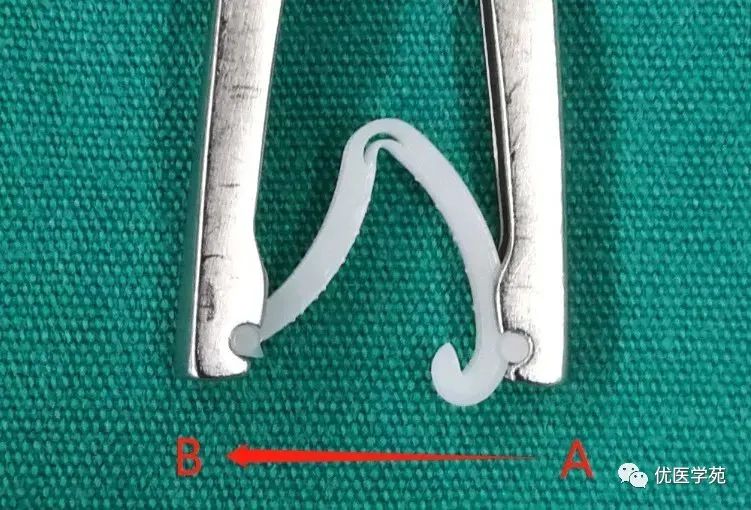 为什么手术会用到结扎夹手术兵器谱篇——止血夹之Hemolok夹，您用对了吗_https://www.jmylbn.com_新闻资讯_第5张