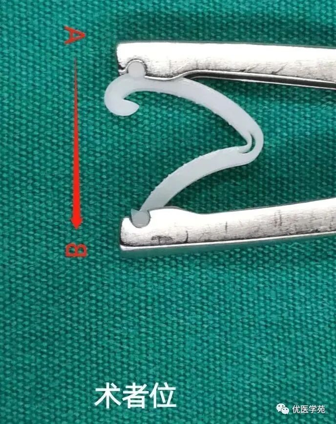 为什么手术会用到结扎夹手术兵器谱篇——止血夹之Hemolok夹，您用对了吗_https://www.jmylbn.com_新闻资讯_第6张