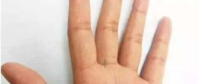 入冬后，中老年人一定要刮刮这条"青筋"，就靠它保命了！