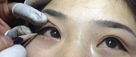 又一起悲剧！作为一名医生，我必须把这个真相告诉所有女性！