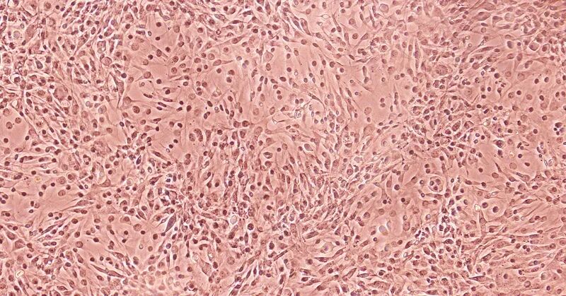 活性守护：处理后的细节把控