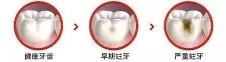 拔烂牙根有危险吗_拔烂掉的牙根多少钱_烂牙根一般几年内必须拔