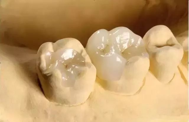 拔烂掉的牙根多少钱_烂牙根一般几年内必须拔_拔烂牙根有危险吗