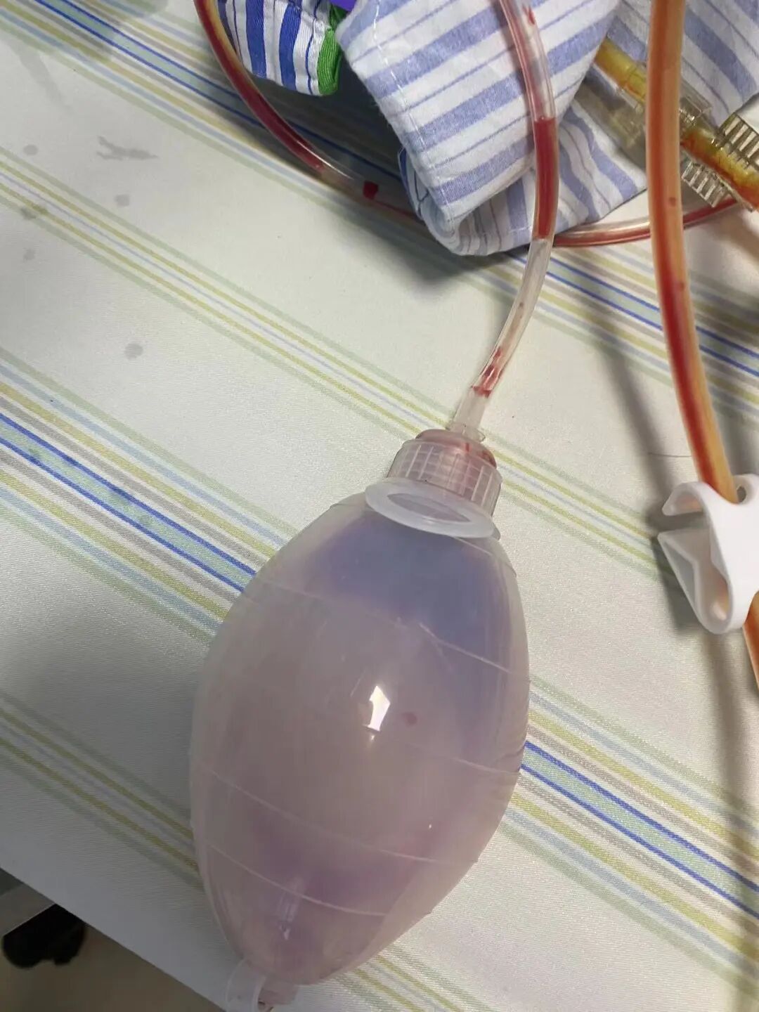 医用导管是干什么用的你知道导管的重要性吗？_https://www.jmylbn.com_新闻资讯_第14张