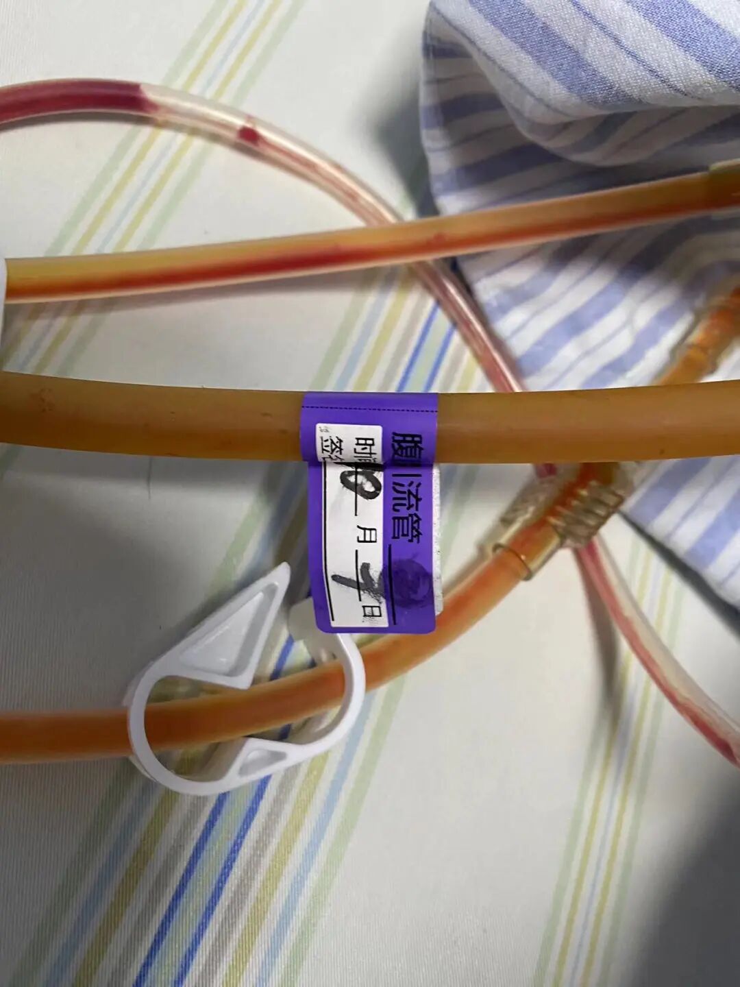 医用导管是干什么用的你知道导管的重要性吗？_https://www.jmylbn.com_新闻资讯_第12张