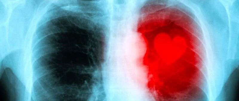 精神压力和愤怒对心力衰竭患者舒张功能指标的影响