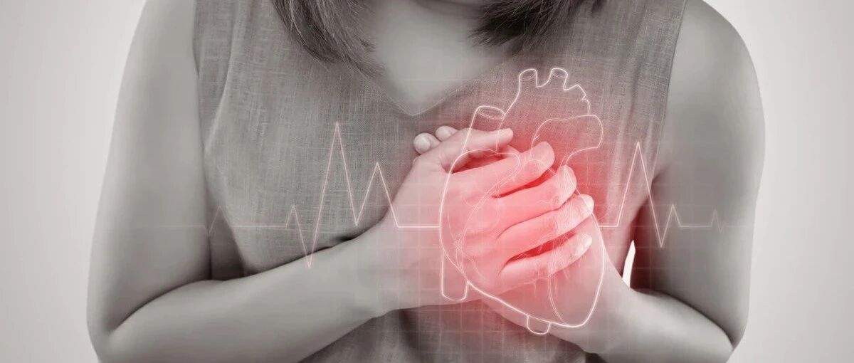 无症状心肌梗死增加未来发生缺血性中风的风险