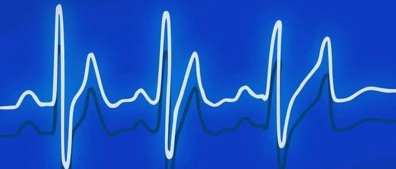 导管消融术与降低房颤患者痴呆风险相关