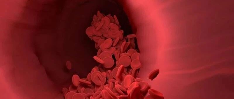 新血液，新希望：输血保护大脑免受中风损害