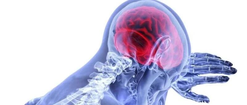 中风闹钟可以简化和加速时间敏感的急性中风护理