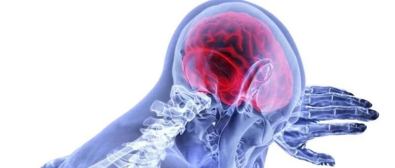 研究发现几种代谢物与中风风险相关