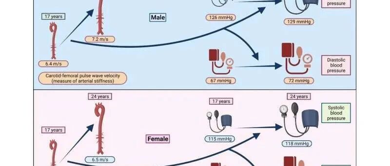 青春期动脉僵硬可能导致成年时高血压和肥胖