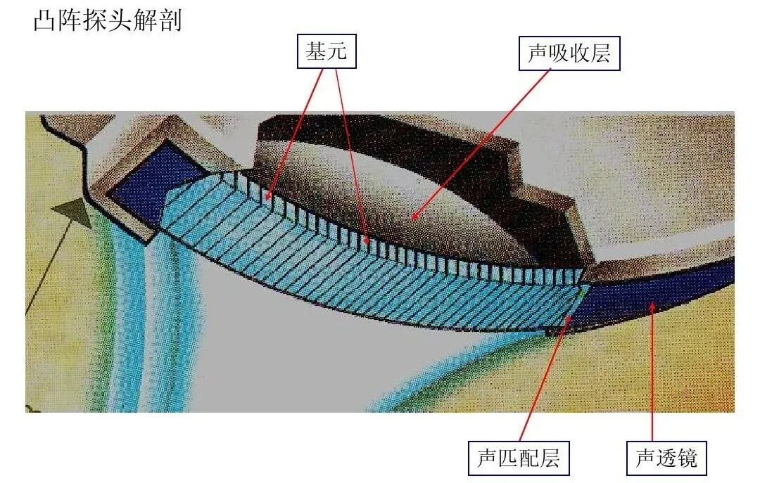 什么是超声容积探头超声基础知识(1)—超声探头的基本构造_https://www.jmylbn.com_新闻资讯_第1张