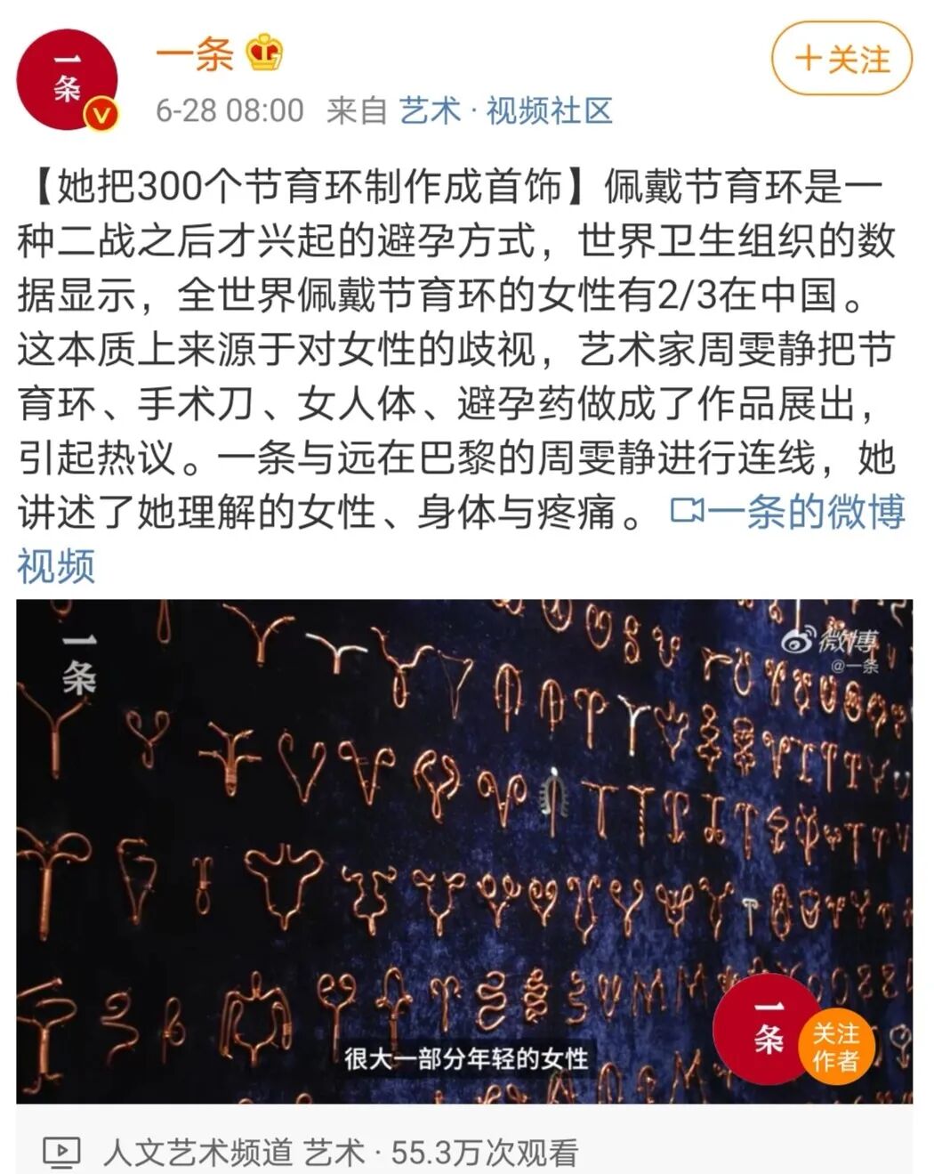 坑人 的节育环 被多少女人遗忘在了体内 不要等 长 进肉里才记起 爱儿康 二十次幂