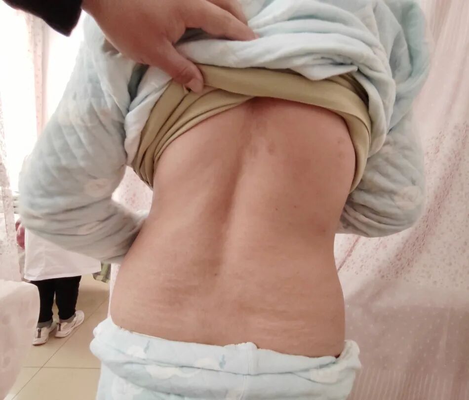 产后怎么康复治疗【品质妇幼】产后康复科：产后精准修复，让美丽宝妈不留遗憾_https://www.jmylbn.com_新闻资讯_第10张