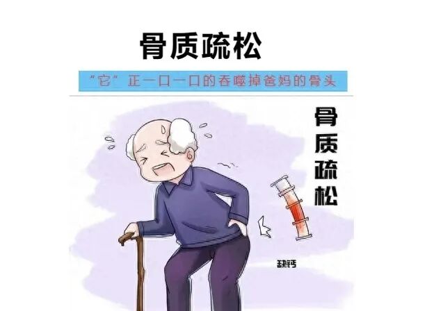 双能x骨密度检测仪为什么非得输入体重身高【查骨质疏松】双能X线骨密度检测→为您的健康“骨”把劲儿！_https://www.jmylbn.com_新闻资讯_第2张