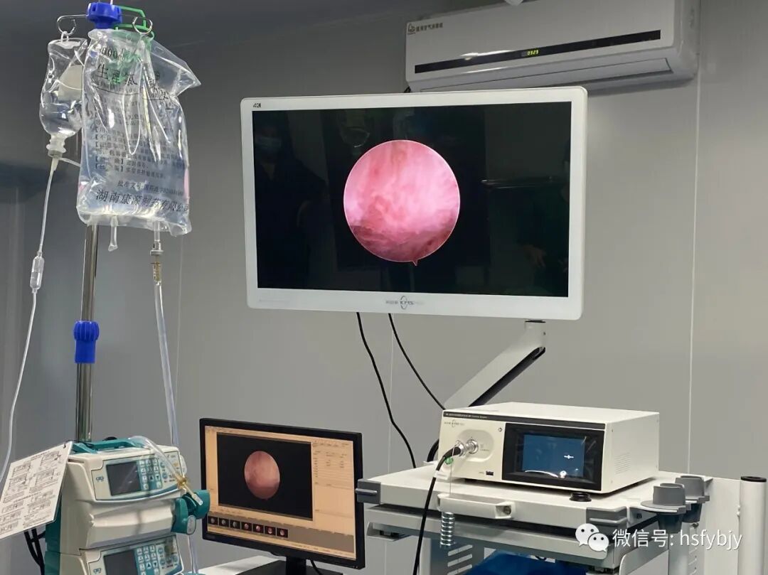 宫腔镜设备包括哪些【医疗技术】以先进医疗设备助力高质量、高水平宫腔镜手术_https://www.jmylbn.com_新闻资讯_第3张