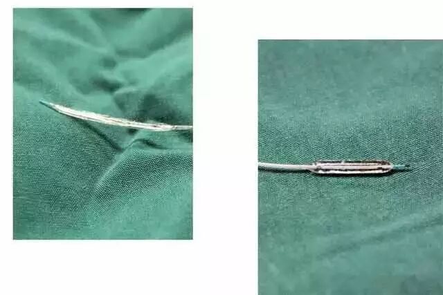 造影导丝是什么请看：这是心脏支架真实的样子_https://www.jmylbn.com_新闻资讯_第17张