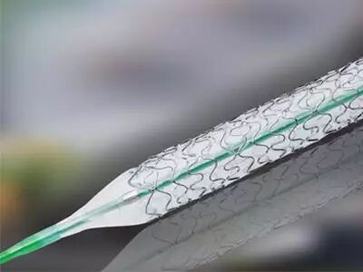 造影导丝是什么请看：这是心脏支架真实的样子_https://www.jmylbn.com_新闻资讯_第19张